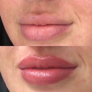 Lips Color or Lips Brushing