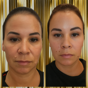 Before and After Plasma Skin Tightening Punta Gorda FL at AmyLashAndBrow
