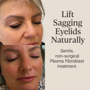 Before and After Plasma Eyelid Lift Punta Gorda FL at AmyLashAndBrow