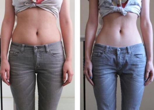 Body Contouring2