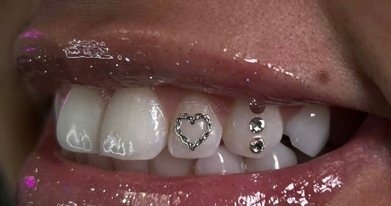 Teeth Whitening