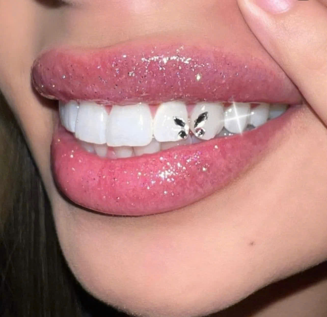 Tooth Gems