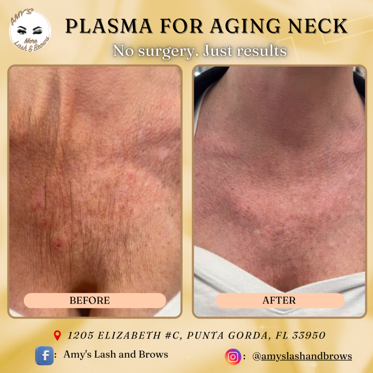 plasma1