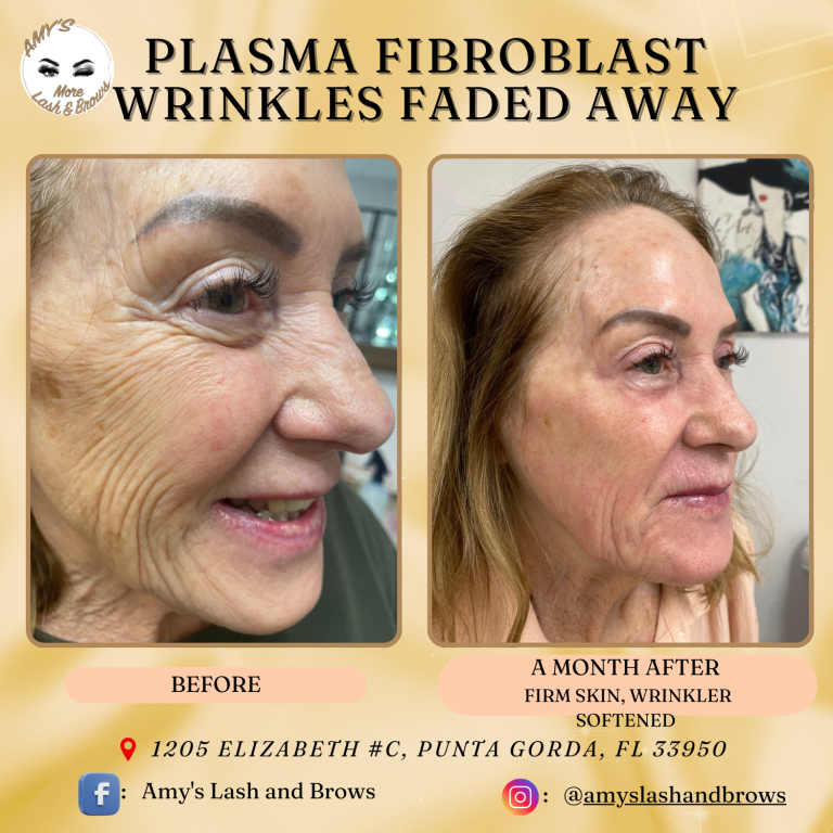 plasma10