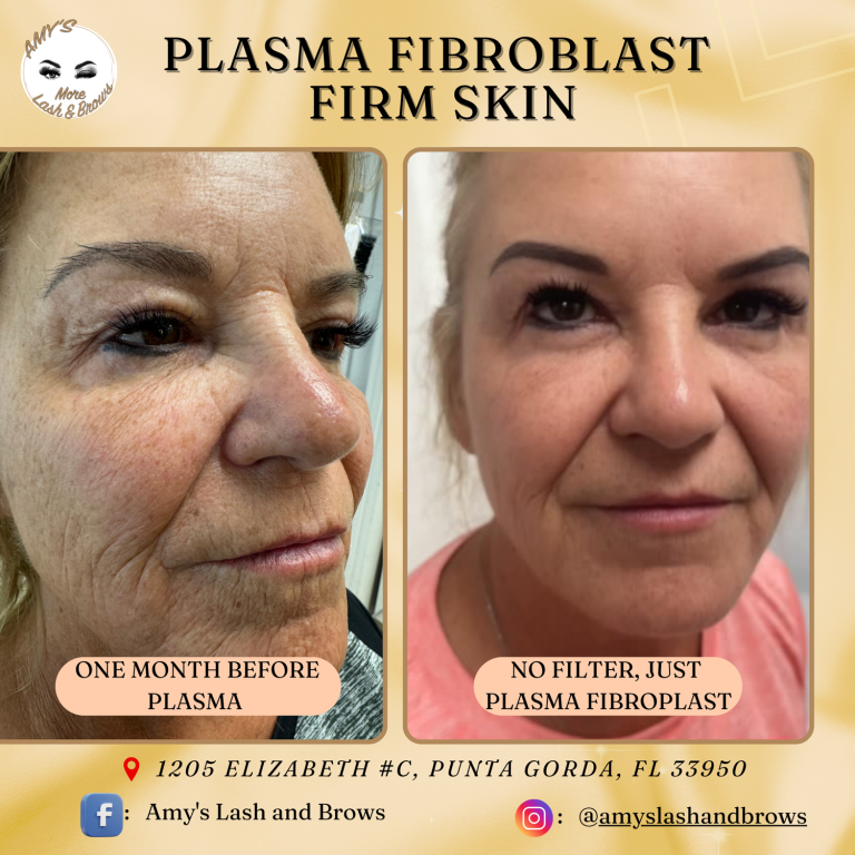 plasma11
