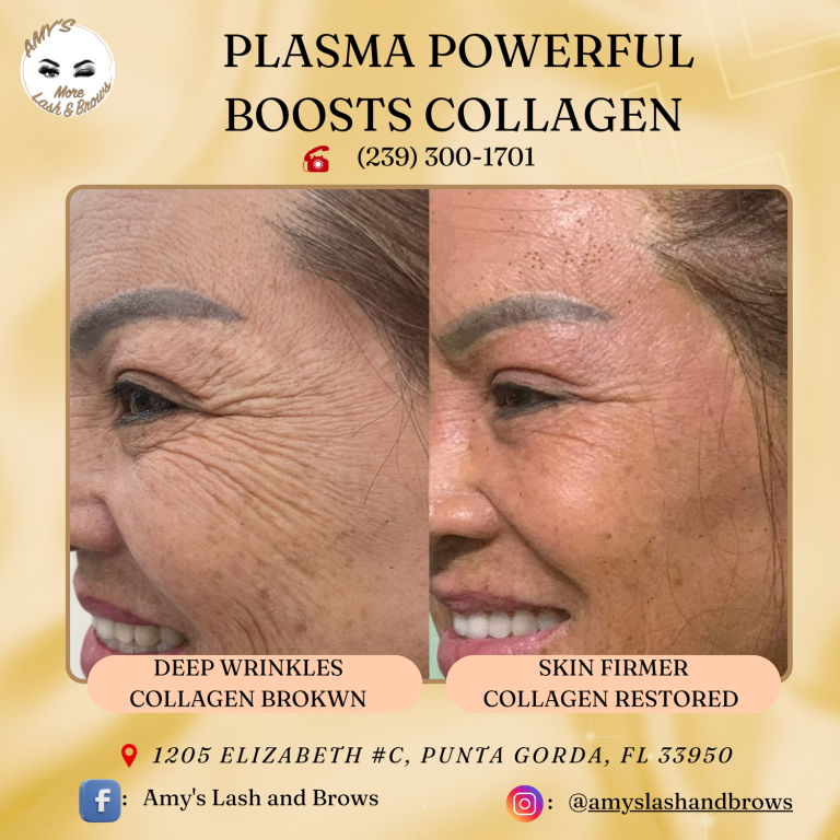 plasma14