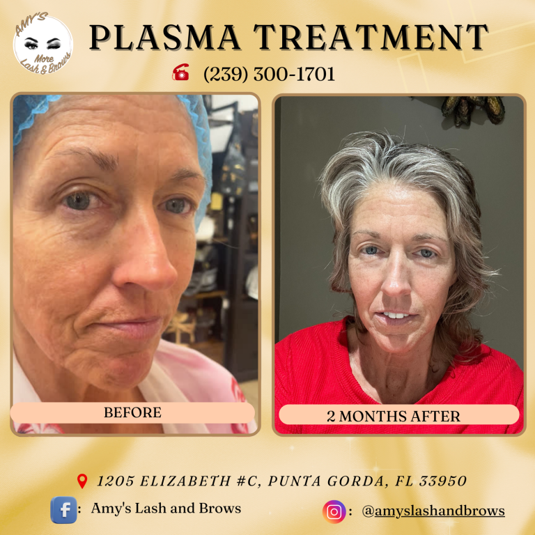 plasma15
