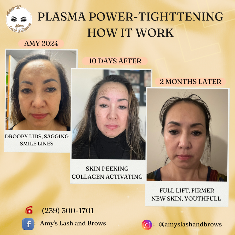 plasma17