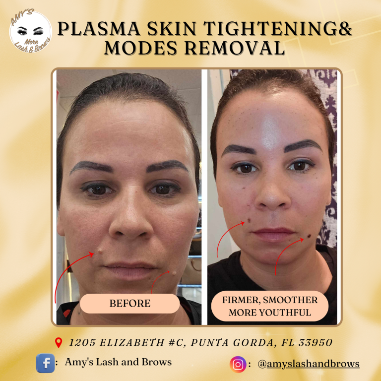 plasma2