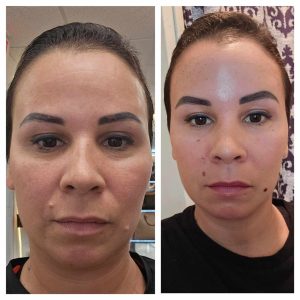 How Long Has It Been Since You Maintained Yourself? Plasma Fibroblast in Punta Gorda 2 Plasma Fibroblast Skin Rejuvenation – Amy Lash and Brows Punta Gorda FL