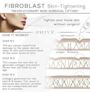 Plasma Fibroblast skin-tightening infographic showing non-surgical lifting process with collagen stimulation, wrinkle reduction, and smoother skin.