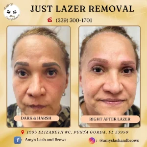 Before and after laser eyebrow tattoo removal in Punta Gorda – Amy’s Lash and Brows. Safe, effective correction for botched or uneven brows.