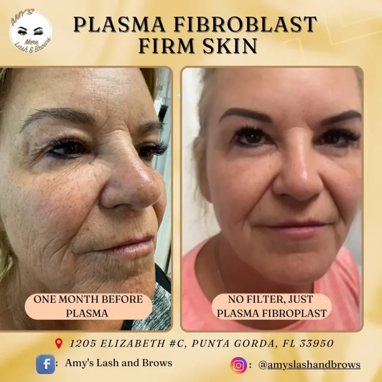 plasma11a-min