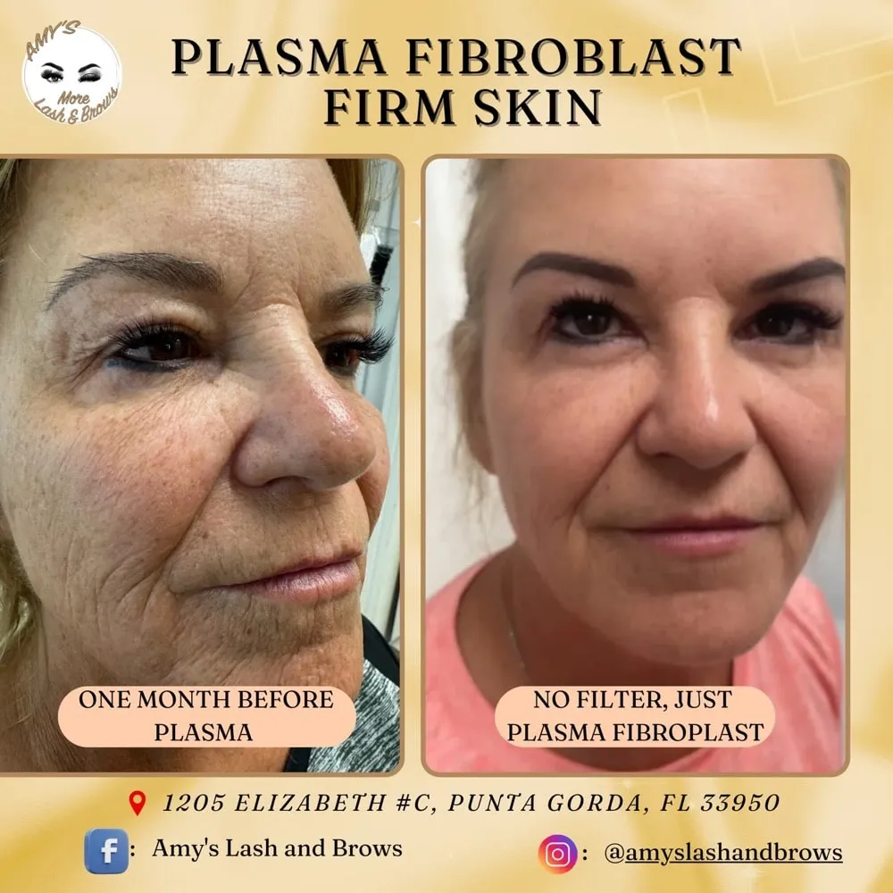 plasma11a-min