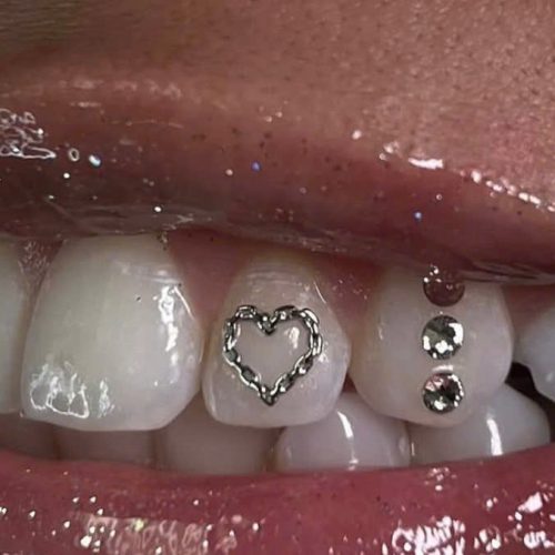 Teeth Whitening