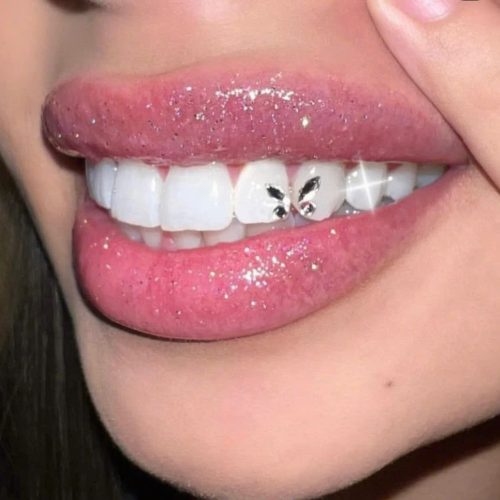 Tooth Gems